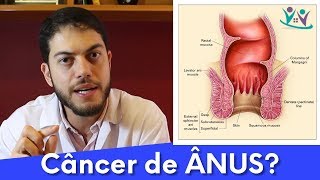 O que você sabe sobre o CÂNCER de ânus  Dr Marcelo Werneck [upl. by Patrica523]