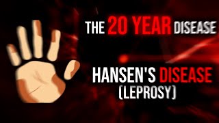 The 20 Year Disease  Hansens Disease Leprosy [upl. by Koy]