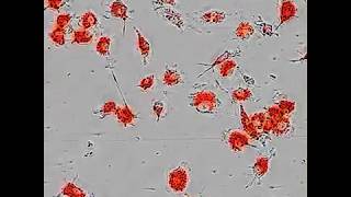 Interaction of SerumExposed Microglial Cultures with pHrodoLabeled Myelin Debris [upl. by Tuneberg]