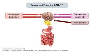 Strategies for Managing Obesity to Reduce Cardiovascular Risks With Weight Loss Pharmacotherapy [upl. by Motch]