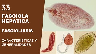 FASCIOLA HEPÁTICA 33  FASCIOLIASIS  TREMATODOS [upl. by Penn690]