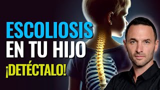 ESCOLIOSIS en tu hijo ¡DETECTALO [upl. by Treblah]