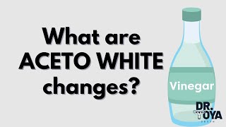 What are ACETOWHITE changes [upl. by Franek92]