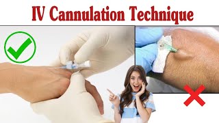 Intravenous Cannulation Technique  IV Cannula Procedure [upl. by Zoa]