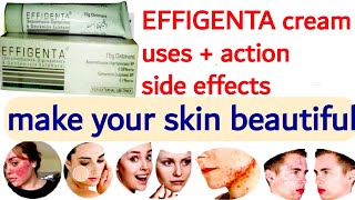 effigenta cream  effigenta cream uses in urdu  effigenta cream review  effigenta cream review [upl. by Agnesse]