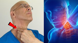 Fix Your Neck Trigger Points in Minutes Become Pain Free  Dr Mandell [upl. by Ut586]