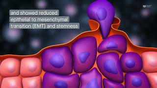 Research  Protein nono promotes the tumorigenicity of breast cancer [upl. by Akiemaj242]