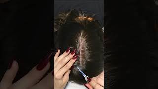 ASMR School Nurse LICE Removal with NAILS and Tweezers Real Person asmr shorts short [upl. by Maritsa181]