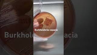 Burkholderia cepacia trên thạch MC BurkholderiaCepacia ViKhuanNguyHiem MacConkey YHoc SucKhoe [upl. by Akirret650]