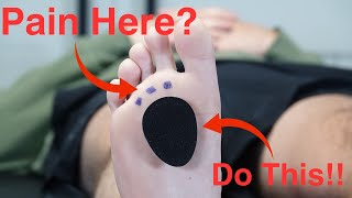 Metatarsal Pad Correct Placement [upl. by Codding38]