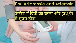 Preeclampsia and eclamsia in hindi [upl. by Doughty937]