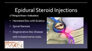 5 Things to Know About Epidural Steroid Injections 602 5076550 [upl. by Aihtekal]