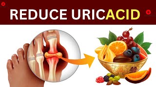 Top 8 Foods That Reduce Uric Acid Levels Naturally [upl. by Mide]