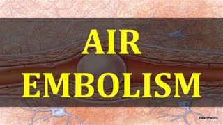 Air embolism during myoma resection by Osama Shawki [upl. by Leacim]