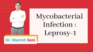 Leprosy Part 1  Hansens disease  Mycobacterial Infection  Dermatology By Dr Manish Soni [upl. by Cressida]