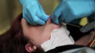 6g labret piercing procedure [upl. by Skippie]