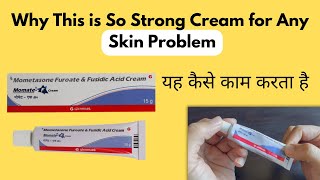 Momate F Cream  Mometasone Furoate amp Fusidic Acid Cream Reveiw  Shoul i Buy [upl. by Westhead]