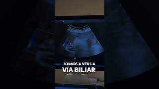 Tips para evaluar la vía biliar en ecografía shorts [upl. by Karalee]