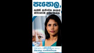 à¶´à·à¶´à·œà¶½ à¶±à·’à·ƒà· à·ƒà¶¸à·™à·„à·’ à¶‡à¶­à·’à·€à·™à¶± à¶šà·à¶½à·à¶½à·Š à¶±à·’à¶§à·Šà¶§à·à·€à¶§à¶¸ à·ƒà·”à·€à¶šà¶»à¶œà¶±à·Šà¶±  chickenpox sinhala  Thunsinhale  2022 [upl. by Ymmac]