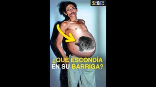 Ocultó un secreto en su barriga por 36 años 🤫 curiosidades [upl. by Aeret]