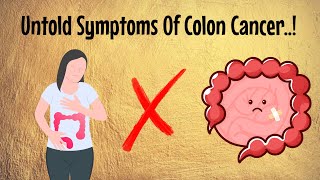 Colon Cancer  Symptoms Prevention Cure which requires urgent investigation [upl. by Tessler]