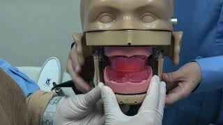 COMPLETE DENTURE 6 Maxillomandibular registration MMR [upl. by Ahsienad]