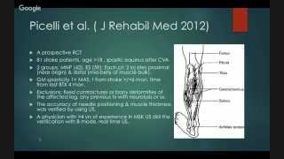 Botulinum Toxin in PostStroke Spasticity [upl. by Gnim]