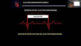 CLASE 3  Taller de Electrocardiografía Básica  RITMOS IRREGULARES [upl. by Sherm]