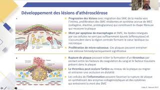 Lien entre dyslipidémie et athérosclérose  mécanismes et épidémiologie [upl. by Aikemal]