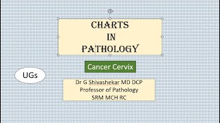 ChartCANCER CERVIX Pathology RATS MBBS SRM Dr GSS University Exam [upl. by Olimpia]