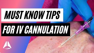 Important tips and tricks for IV cannulation [upl. by Eical]