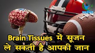 Brain TB Brain Tissues में में सूजन आ जाने से होती है यह गंभीर बीमारी जानें कैसे करेंगे इलाज [upl. by Ledniahs742]