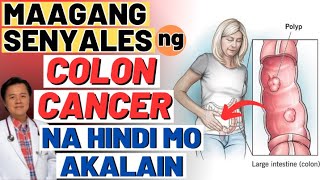 Maagang Senyales ng Colon Cancer na Hindi Mo Akalain  Tips By Doc Willie Ong [upl. by Esirtal]