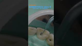 Essentials in endodontics ULTRA X eighteeth [upl. by Forrest]