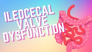 ILEOCECAL ICV VALVE DYSFUNCTION [upl. by Hertha]