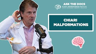 Ask the Docs 🥼🧠  Chiari Malformations with Dr Erol Veznedaroglu [upl. by Hauser]