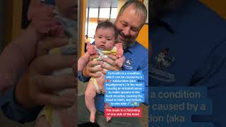 Torticollis in infants can be treated by pediactric Chiropractors torticollis baby infant [upl. by Yesnel]