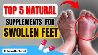 5 Effective Natural Supplements to Reduce Swollen Feet and Ankles Fast [upl. by Male]