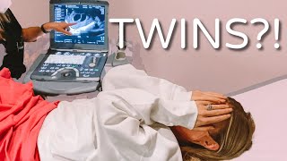 SHOCKING ULTRASOUND TWINS  LAUREN amp ARIE [upl. by Quartet]