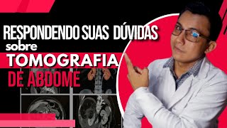 Respondendo todas as suas dúvidas sobre o exame de tomografia de abdome total Radiologia [upl. by Annayek629]