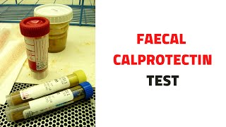 FECAL STOOL CALPROTECTIN TEST Uses Inflammatory Bowel Disease [upl. by Ennairak]