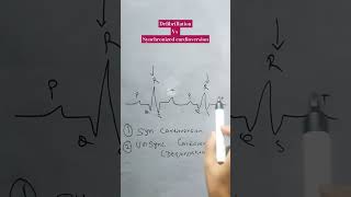 defibrillation vs synchronized cardioversion defibrillationcardioversion [upl. by Eikcim694]