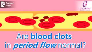 Why does menstrual bleeding have blood clots Is it normalDrShalini Varma of Cloudnine Hospitals [upl. by Eecal]