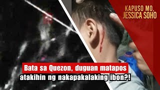 Bata sa Quezon duguan matapos atakihin ng nakapakalaking ibon  Kapuso Mo Jessica Soho [upl. by Jordanson]