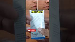 anti scars medicinescarzit gel [upl. by Aggie]