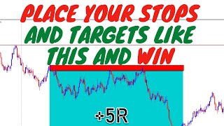 Place Your Stops And Targets Like a PRODONT GET STOPPED OUT [upl. by Intruoc636]