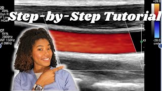 How to Perform Carotid Ultrasounds  A Simple Guide for Beginners [upl. by Eiruam]