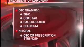 How does work Nizoral 2 Shampoo Anti Dandruff Fungus Hair Loss Treatment Shampoo [upl. by Beker]