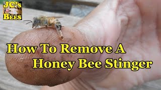 Got Stung By a Honey Bee Heres How You Can Fix ItFast [upl. by Aivirt]