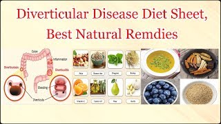 Diverticular Disease Diet Sheet Best Natural Remdies [upl. by Golding]